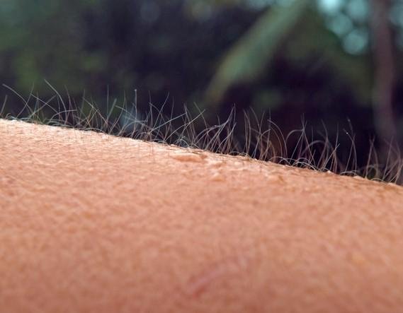 Close up of human skin illustrating how drug resistant Candida auris can colonise and spread on the body