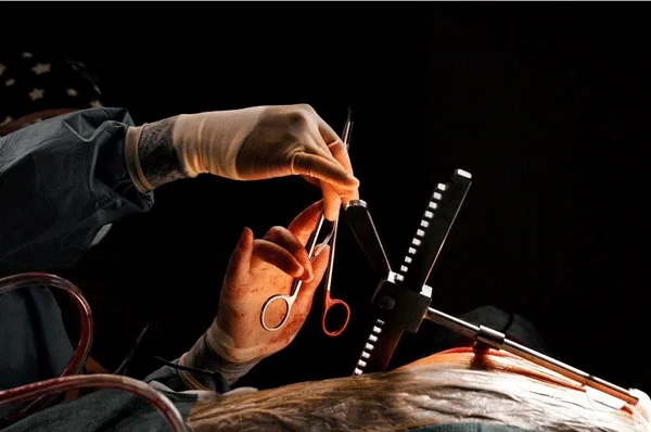 A moment during heart surgery observed by Thomas D Wright, where precision and focus meet the fragile reality of the human body. 0000