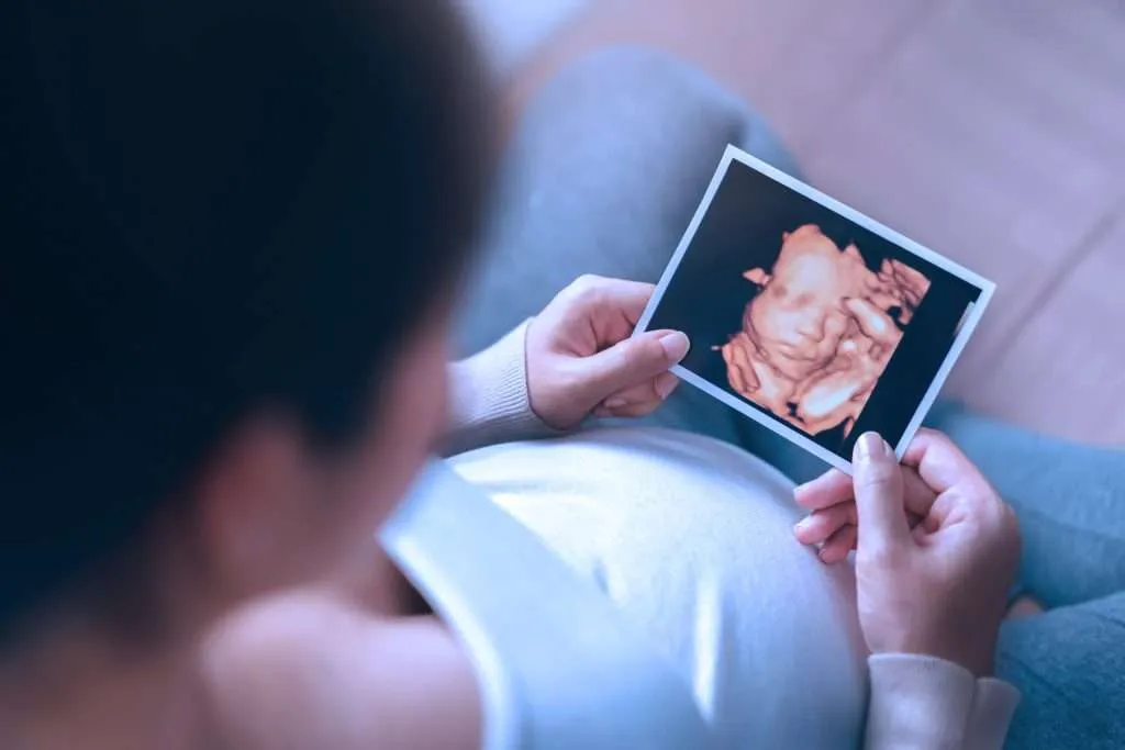 Pregnant woman holding an ultrasound image illustrating pregnancy diet and baby brain development.